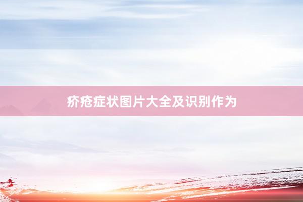 疥疮症状图片大全及识别作为